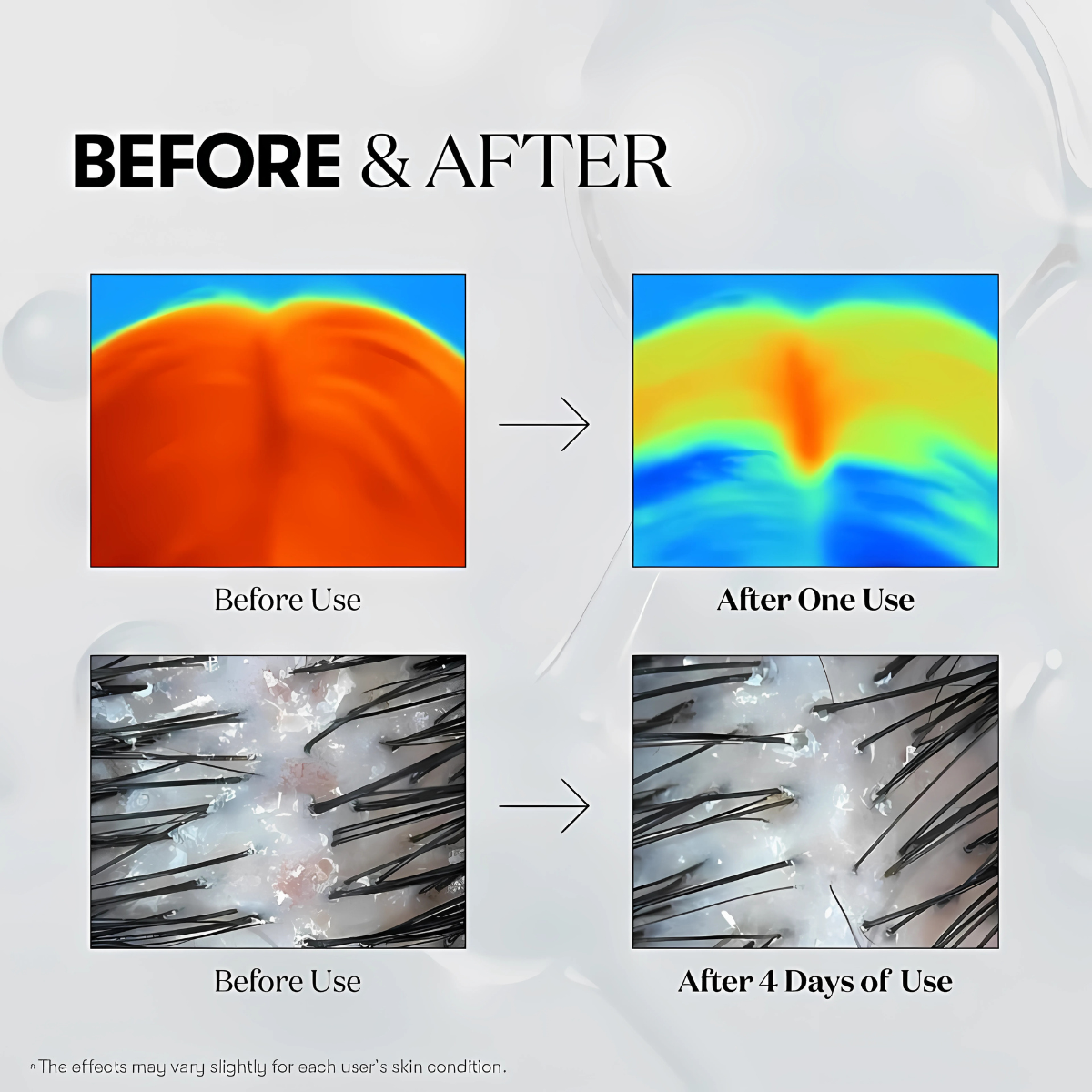 Hair Renewal Ampoule